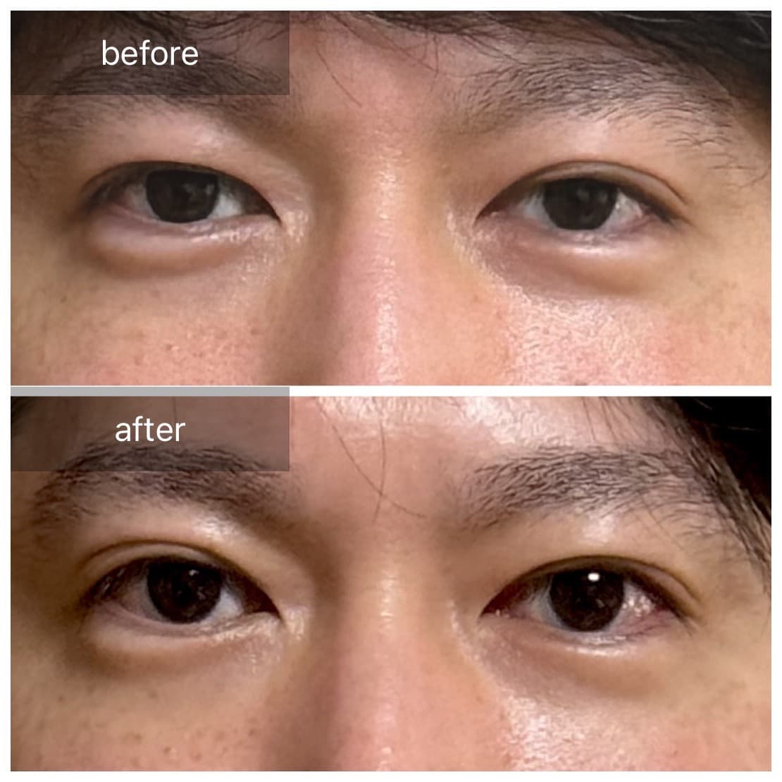 32歳男性 施術風景