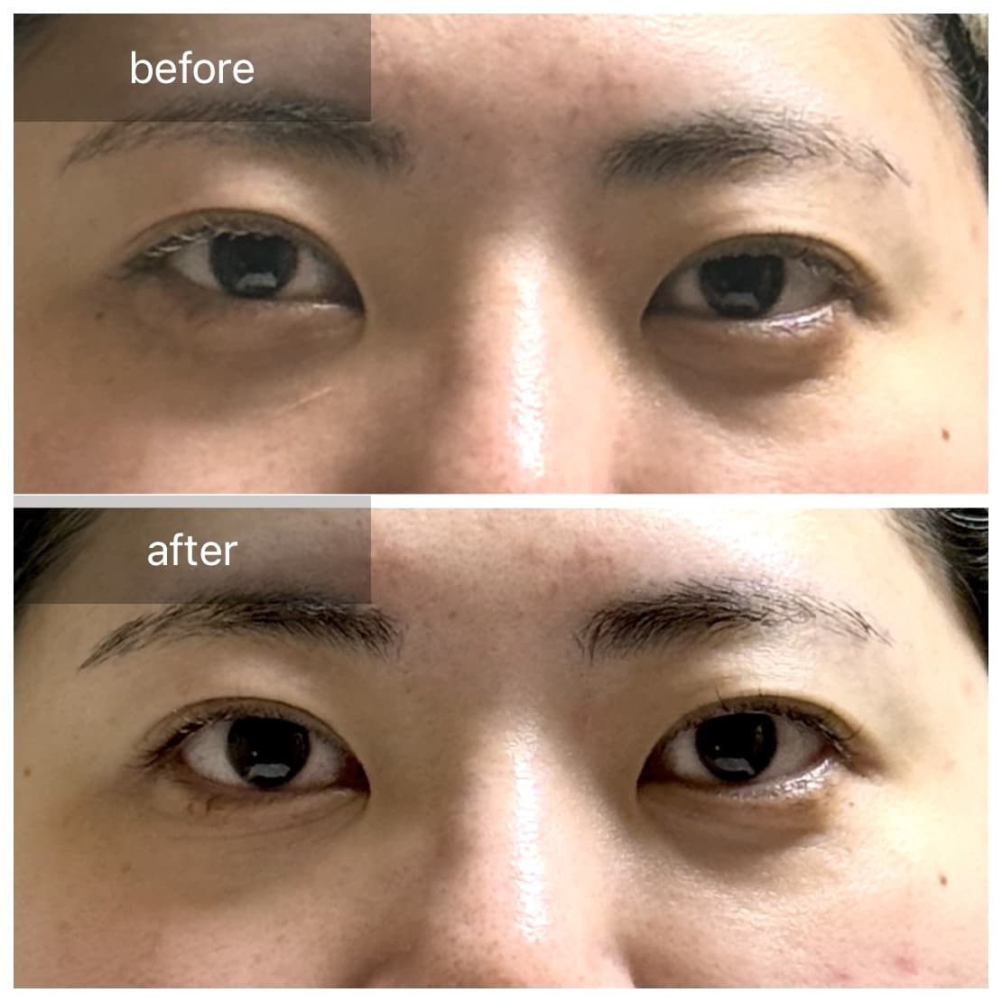 20代会社員 施術風景